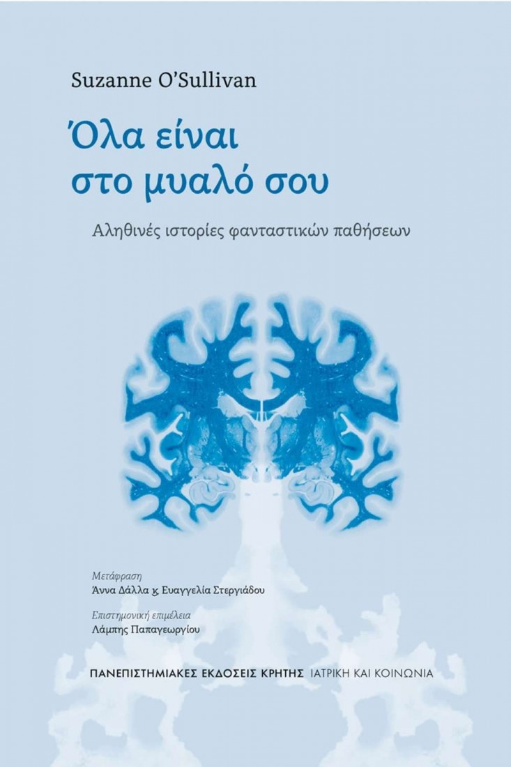 Όλα είναι στο μυαλό σου